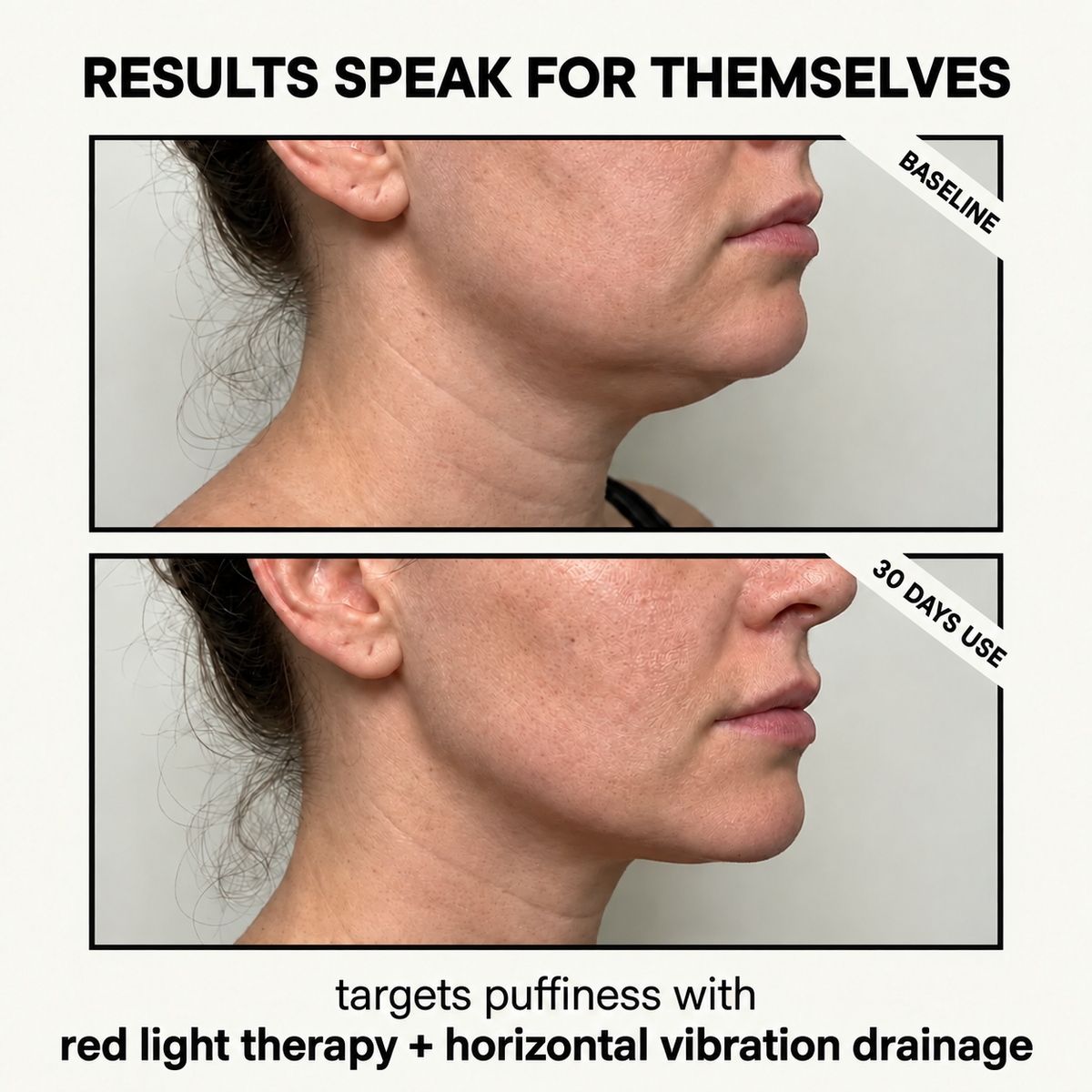 Solene DualGlow™ Face + Scalp Massager
